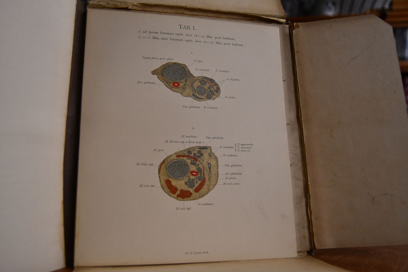 Topographische Anatomie des menschlichen Orbitalinhalts in Tafeln.